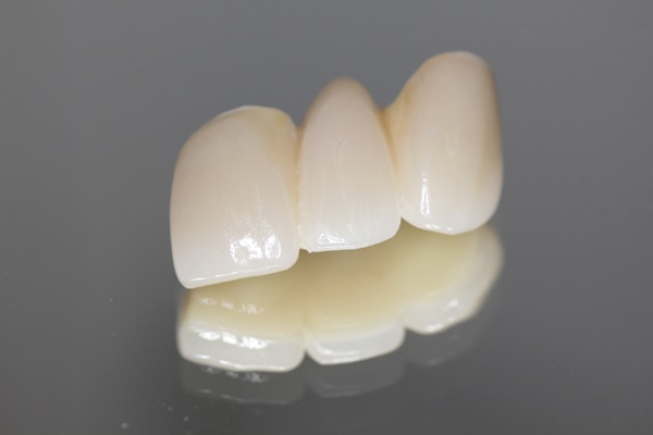 Dental Bridge Options: How Bridges Replace Missing Teeth And Support Bite Function