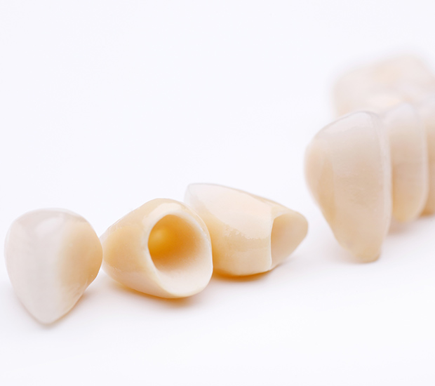 Albany Dental Crowns and Dental Bridges