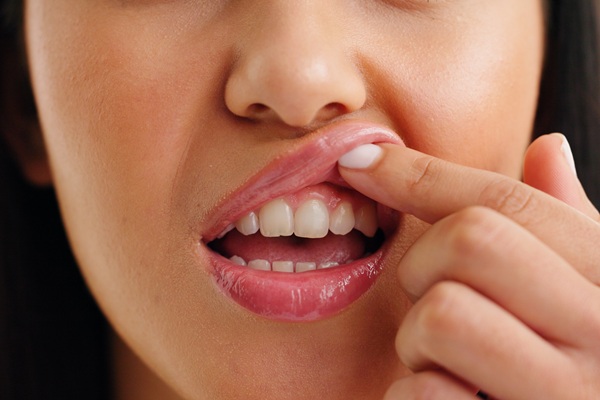 How A Family Dentist Provides Gum Disease Treatment