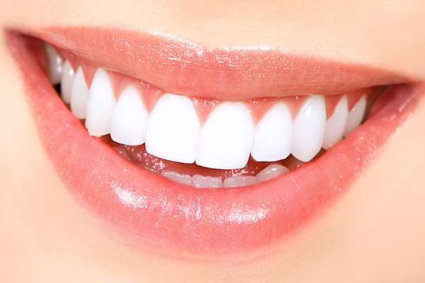 How Long Does Teeth Whitening Take from Elm Street Family Dental in Albany, OR