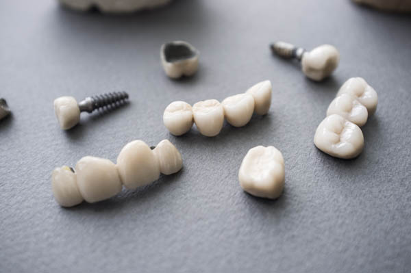 How Long Does An Implant Crown Restoration Last?