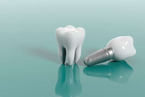 Multiple Teeth Replacement Options: One Implant for Two Teeth from Elm Street Family Dental in Albany, OR