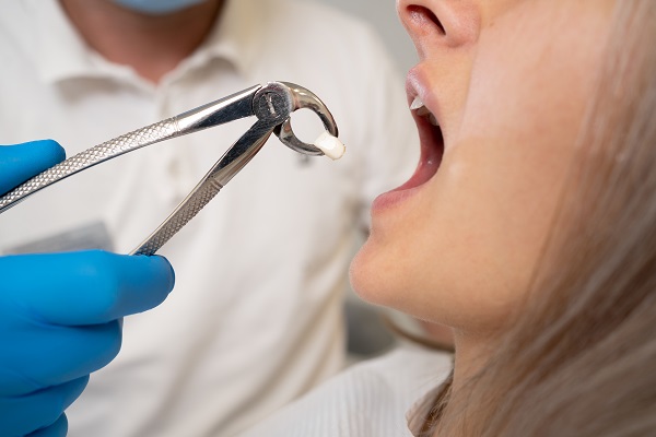 Signs You May Need A Wisdom Tooth Extraction